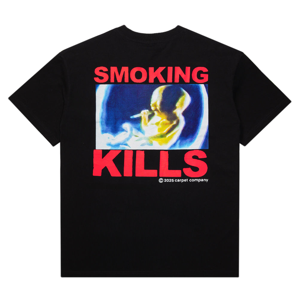 SMOKING KILLS TEE